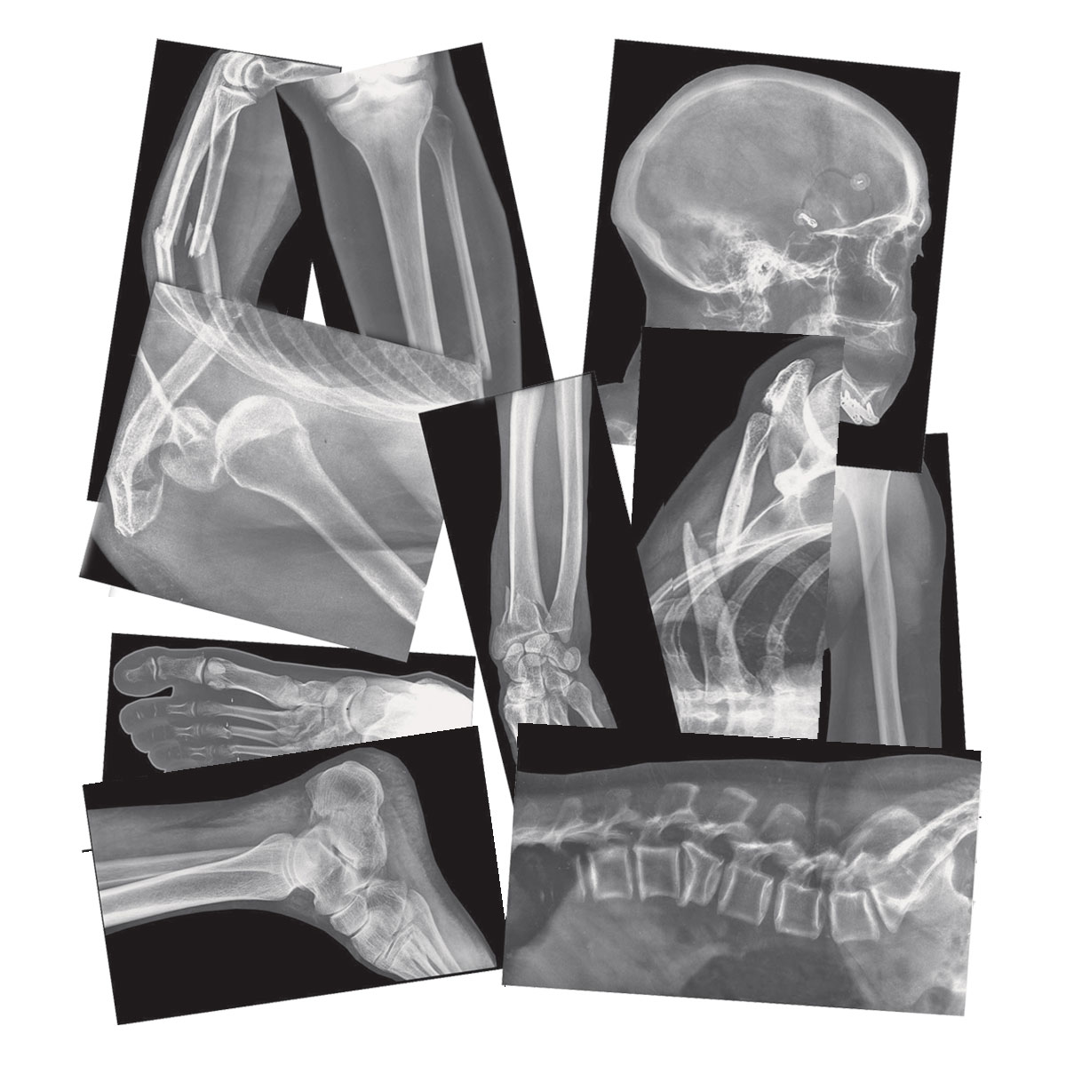 18 Theme/subject: Radiology Skill Learning: Radiography Roylco Human X-ray 